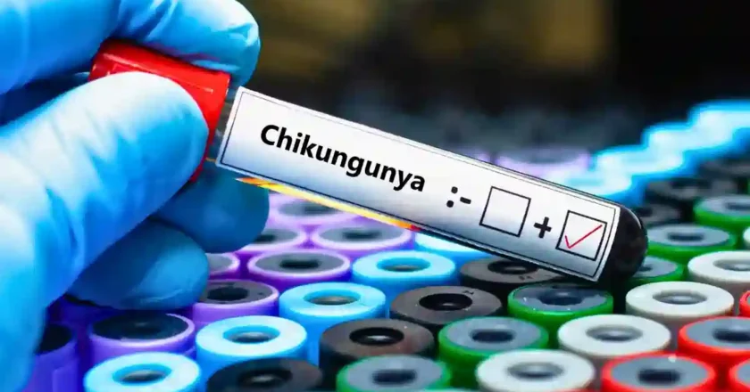 Suben los casos de chikungunya y refuerzan el monitoreo del dengue en Argentina